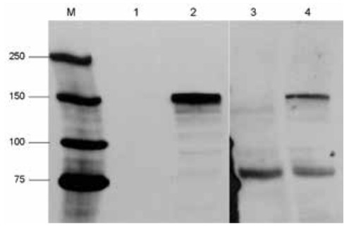 western blot using monoclonal anti-Cas9 antibodies